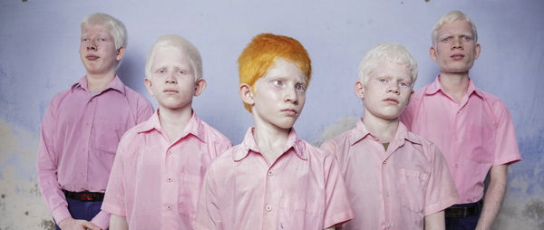 Jovenes albinos de una escuela 54401180110 53389389549 600 396
